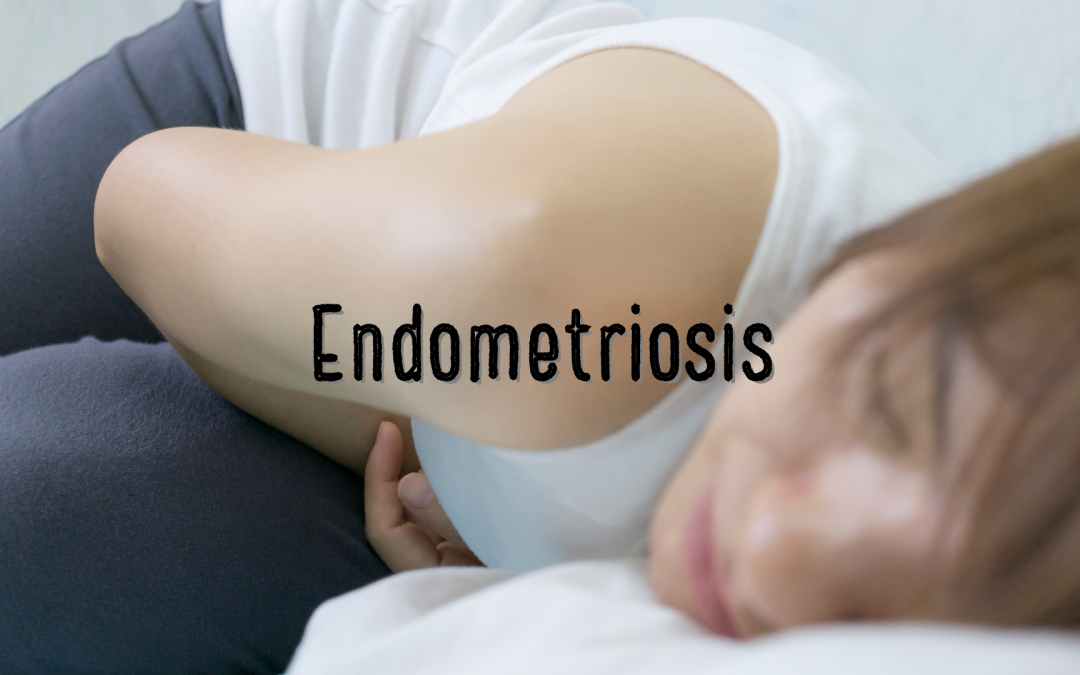 Endometriosis – Not the same stuff you already know